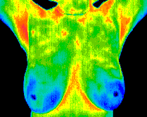 breast thermography scan image