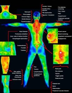 full body thermography scan image