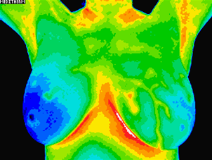 image of patient B second scan