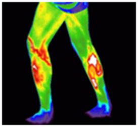 lower body thermography scan image