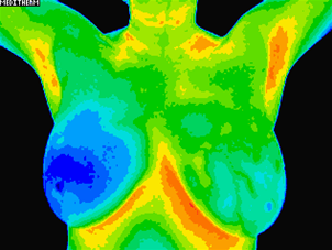 image of patient B first scan