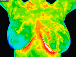 image of patient B third after scan